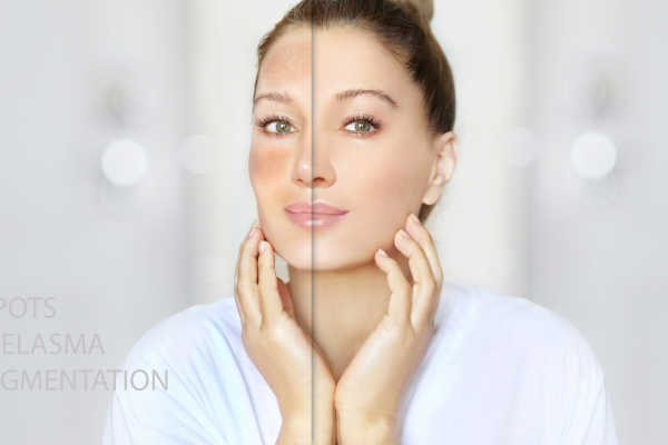 Why Our Skin Gets Dry in Winter And How to Actually Fix It