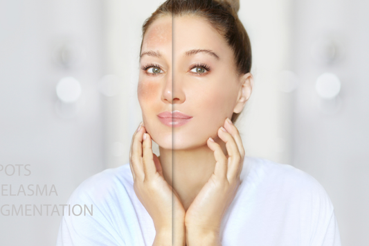 Why Our Skin Gets Dry in Winter And How to Actually Fix It